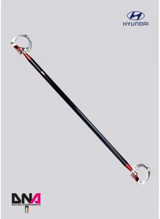 Hyundai I20N DNA Racing karbonszálas első toronymerevítő Hyundai I20N DNA Racing karbonszálas első toronymerevítő